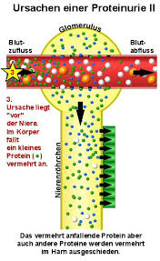 Eiweiss Im Harn Proteinurie Details