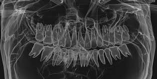 Pin By Dr Douglas Hauck On Today S Dentistry Dentistry Neon Signs Advanced Technology