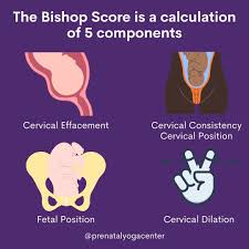 Image result for Bishop Score