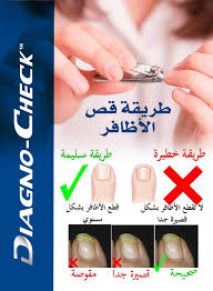 علابالك_بلي يجب اتباع خطوات الوقاية لتجنب المضاعفات ::- - يجب فحص الأظافر  بشكل يومي. ـ يجب قص الأظافر باستخدام مقص جيد ومناسب. ـ لا تقطع الأظافر بشكل  قصيرة جدا. ـ لا تقطع