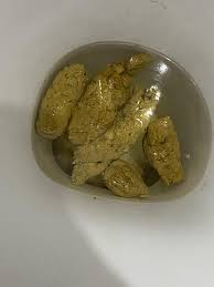 Image result for yellow stool human poop