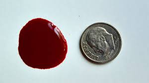 Jan 19, 2021 · test your knowledge of the early signs of pregnancy in our poll, and read on for more. What Does Spotting Or Bleeding In Early Pregnancy Mean Wehavekids