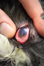 Image result for Eye Foreign Body