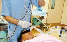 Image result for Intubation Associated Sinusitis