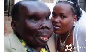 Following outcry from the public, the gallery has subsequently removed the exhibit from display. Michy Blog Meet The World S Ugliest Man With Eight Facebook