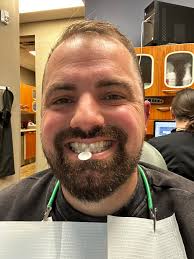 My inspire flips over when lying