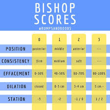 The bishop score was developed by professor emeritus of obstetrics and gynecology, dr. Pin On Bishop Score