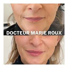 Docteur Marie Roux