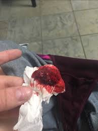 We did not find results for: Family Magazine Miscarriage Or Heavy Period