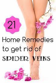 Home Remedy Hacks Get Rid Of Spider Veins Treat Spider Veins Spider Veins