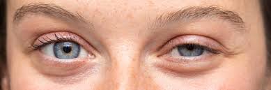 Image result for Blepharis transvaalensis