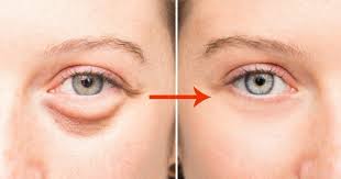 104 Yasindaki Kanser Uzmani Kanseri Yok Eden Icecegi Kesfetti Saglik Paylasimlari 2020 Saglik Cilt Urunleri Kore Cilt Bakimi