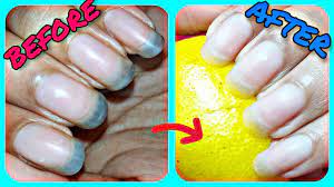 How Can I Keep My Nails Clean And Shiny - Youtube