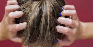 10 Reasons Your Scalp Might Be Itchy And What To Do About It With Images Itchy Scalp Causes Itchy Scalp Dying Hair