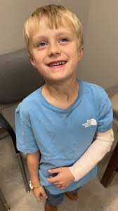 Brain Cancer Causes and Concerns