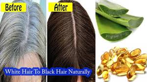 This mostly happens with the people who spend a lot of time under the sun. White Hair Problem Solution Naturally With Aloe Vera And Vitamin E Whit Hair Problems Solutions Hair Vitamins Hair Medicine