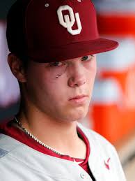 Big 12 baseball notebook: OU's Jake Irvin takes shot to the face