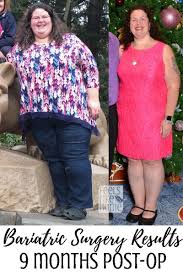 Pin On Eating After Bariatric Surgery