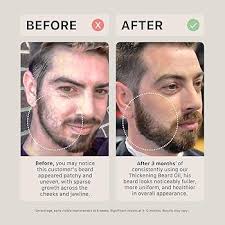 Amazon.com: ACTIIV Thickening Beard Oil (Unscented)