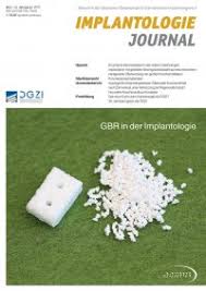 Desene animate dublate în limba română cu tina și tony pentru copii. Titel Redaktion Editorial Im Fokus Das Neue Modulare Fortbildungskonzept Der Dgzi Dr Friedhelm Heinemann Prasident Dgzi Knochenersatzmaterialien In Der Oralen Implantologie Einteilung Und Eigenschaften Bergen Pak Dr Pablo Hess Frankfurt Am