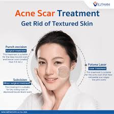 Check spelling or type a new query. Get Rid Of Textured Skin With Acne Scar Treatment Vejthani Hospital Vejthani Hospital Jci Accredited International Hospital In Bangkok Thailand