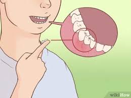 Poor dental hygiene.not taking proper care of your teeth and gums — such as not brushing your teeth twice a day and not flossing — can increase your risk of tooth decay, gum disease, tooth abscess, and other dental and mouth complications. How To Alleviate Toothache Pain 11 Steps With Pictures