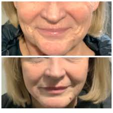 Good morning all, here at McIntyre Corbett and associates we are delighted  to welcome Dr Fiona Purss General Dental Council registration 152033 to  join our team here in Dingwall. She combines technical