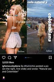 kali lying about BBL/plastic surgery? : r/kaliuchis