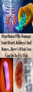 Pin By Emma Lisa On Pin Educations Heartburn Best Diet Pills Best Diets