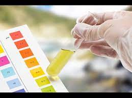 Que Nos Dice El Color De La Orina Sobre Nuestra Salud Youtube