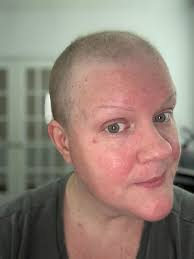 Brandi's Inflammatory Breast Cancer Journey