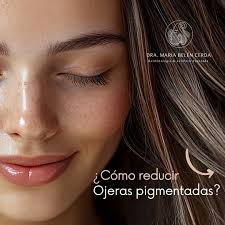 Las ojeras son esas manchas oscuras que se ven debajo de los ojos y que  muchas veces nos hacen ver cansados o con un aspecto más apagado.⁠ ⁠Esto  pasa porque la piel