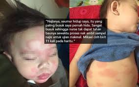 Gastroenteritis adalah radang dalam perut atau sistem penghadaman yang berlaku akibat jangkitan. Kanak Kanak Muntah 9 Kali Sehari Badan Kemerahan Cirit Birit Gara Gara Susu Tiruan