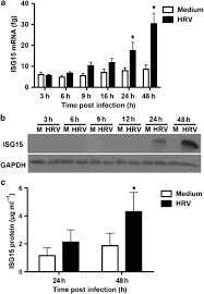 Twelve percent of patients had rhinovirus or coronavirus identified (rhinovirus, 4 patients; Human Rhinovirus Induced Isg15 Selectively Modulates Epithelial Antiviral Immunity Mucosal Immunology