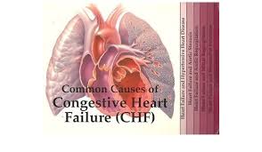 Heart failure is a complex clinical syndrome that results from any functional or structural heart disorder, impairing ventricular filling or ejection of blood to the systemic circulation to meet the systemic needs. Common Causes Of Congestive Heart Failure Humanatomy 13 Amazon De Peters Tim Fremdsprachige Bucher
