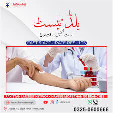 Image result for Hum Test