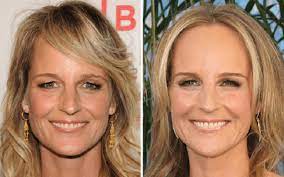 At the moment, we cannot confirm helen hunt plastic surgery. Helen Hunt Plastic Surgery Facelift Botox Car Accident Movies Twister