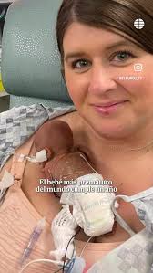 El Bebé más prematuro del mundo