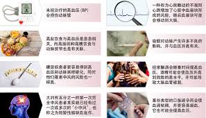 52:03 北京卫视电视综艺频道 8 668 просмотров. é«˜è¡€åŽ‹å'Œè„'ä¸­é£Ž My Health My Life