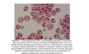 Image result for CSF Gram Stain