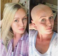 Pin On Hair Before After 07