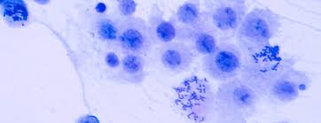 Prenatal Testing For Down Syndrome Patient Education Ucsf Health