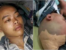 Jan 7, 2019 update terakhir: Terkena Tumor Otak Remaja Ini Butuh Bantuan Dana Untuk Operasi Sumut Indozone Id