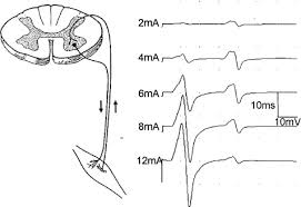 A reflex pathway that has been employed in this regard is the hoffmann (h) reflex. Neurography Late Responses Bischoff 2002 Muscle Amp Nerve Wiley Online Library