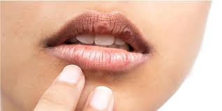 Check spelling or type a new query. Kenali 8 Penyebab Bibir Kering Dan Cara Mencegahnya