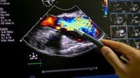 Image result for how does medicare pay for a echocardiogram