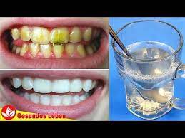 keine notwendigkeit zum zahnarzt zu gehen zahne aufhellen schnell mit diesem mundwasser youtube zahnarzt mundwasser zahne