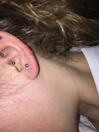 We did not find results for: Is My Lobe Piercing Infected Quora