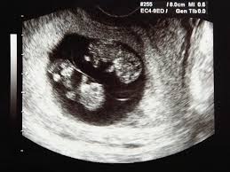 Why would i have a dating scan? My Baby S Age On The Scan Report Is Different To My Stage Of Pregnancy What Does This Mean Babycenter India