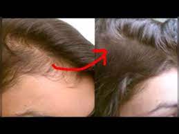 Find the right serum for your hair. Magical Hair Serum Grow Long Thick Hair Jsuper Kaur Youtube
